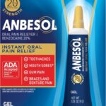 Best Oral Pain Relief – Anbesol Gel Maximum Strength – Instant Oral Pain Relief for Toothaches, Canker Sores, Sore Gums, Denture Pain – 0.33 oz Review